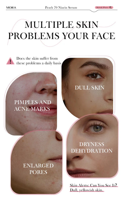 Niacinamide Brightening Serum - Dark Spot & Pore Minimizing Treatment