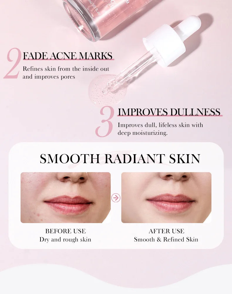 Niacinamide Brightening Serum - Dark Spot & Pore Minimizing Treatment